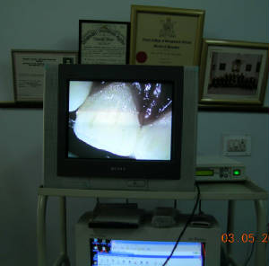 Microscope Enhanced Dentistry
